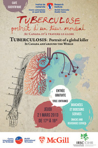 Tuberculose : portrait d’un tueur mondial - au Canada et à travers le globe 